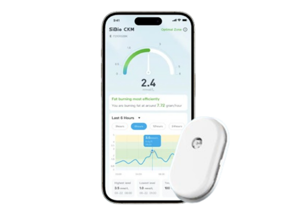 SiBio KS1 Continuous Ketone Monitoring System providing real-time ketone levels